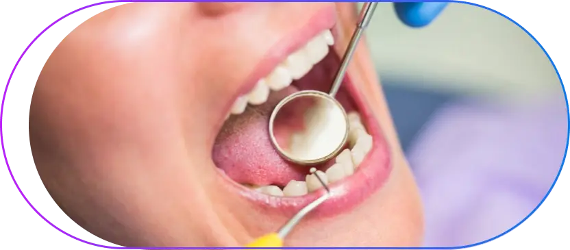 Dental Filling in Kolkata Dental Filling in Kolkata