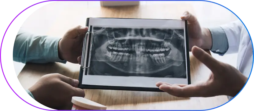 Dental X-ray Dental X-ray